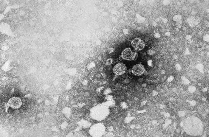 Particules du virus de l’hépatite B en microscopie électronique à transmission, 1981.