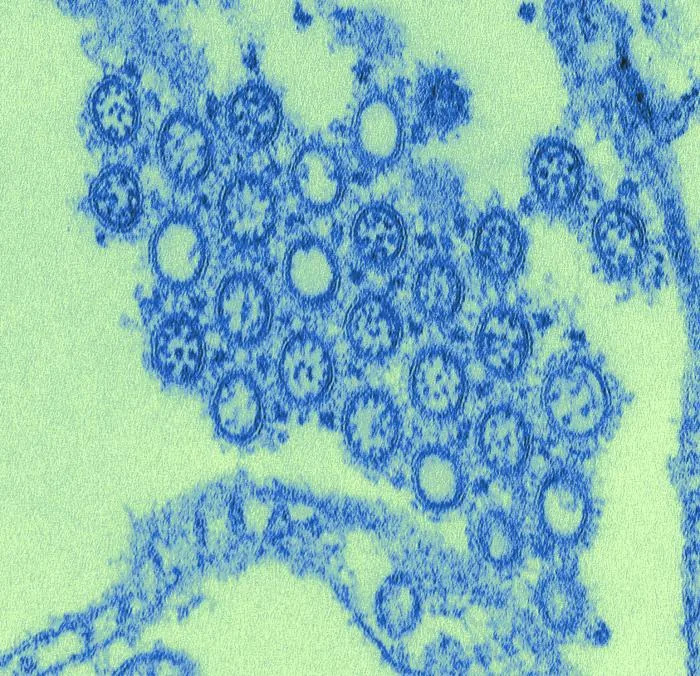 Particules d’un isolat de grippe A H1N1 de 2009, en microscopie électronique à transmission, colorisées.