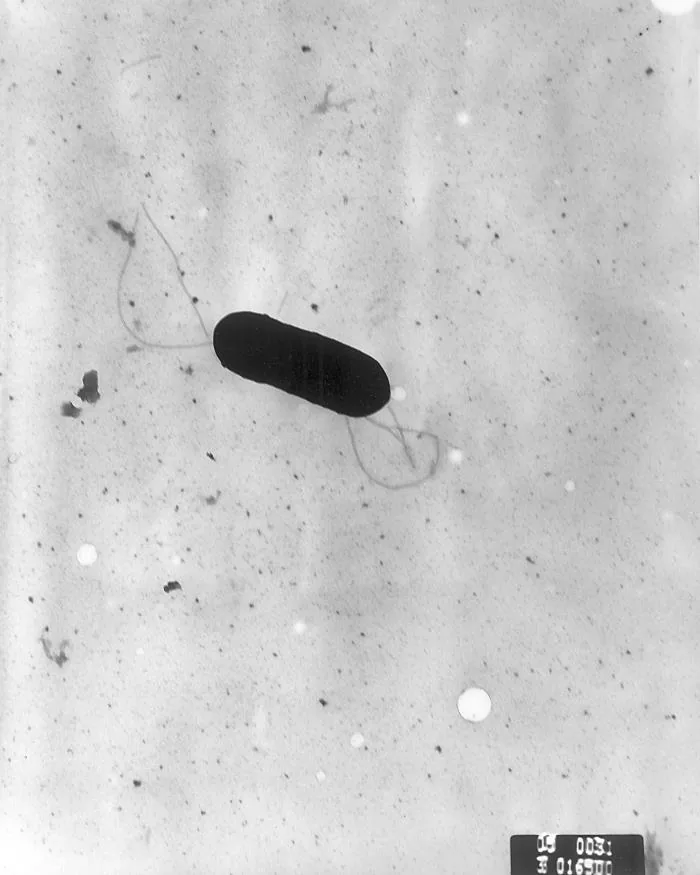 Bactérie Listeria monocytogenes en microscopie électronique à transmission, 2002.