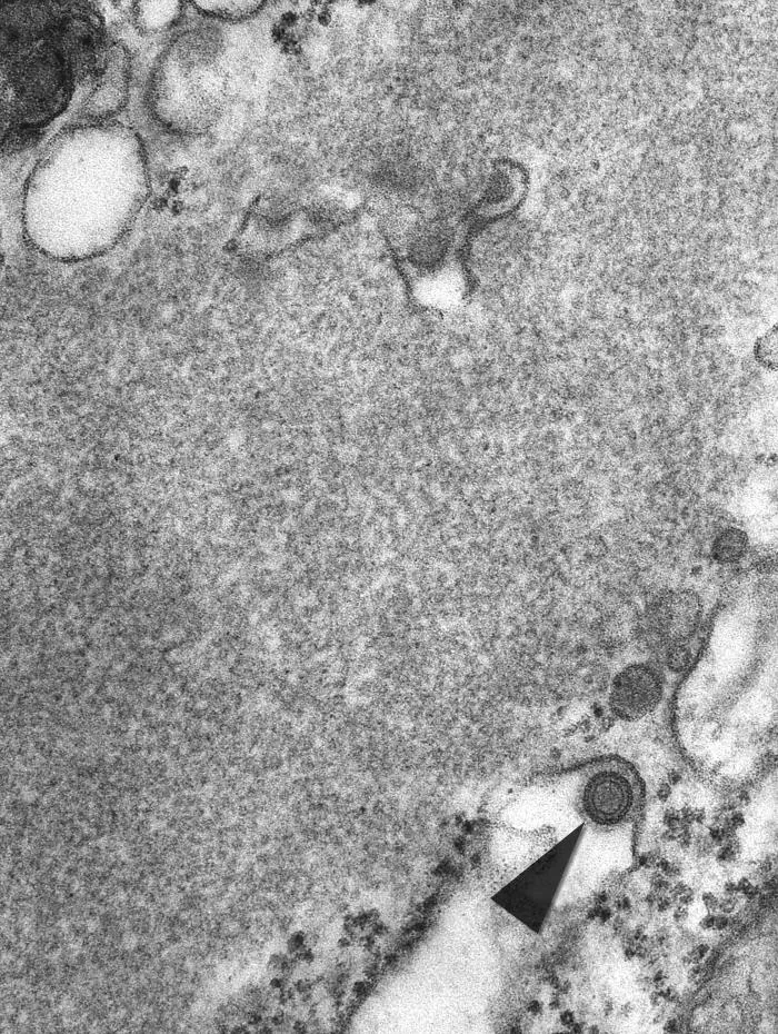 Coupe de tissu observée en microscopie électronique montrant une particule du virus de la rage, 1975.