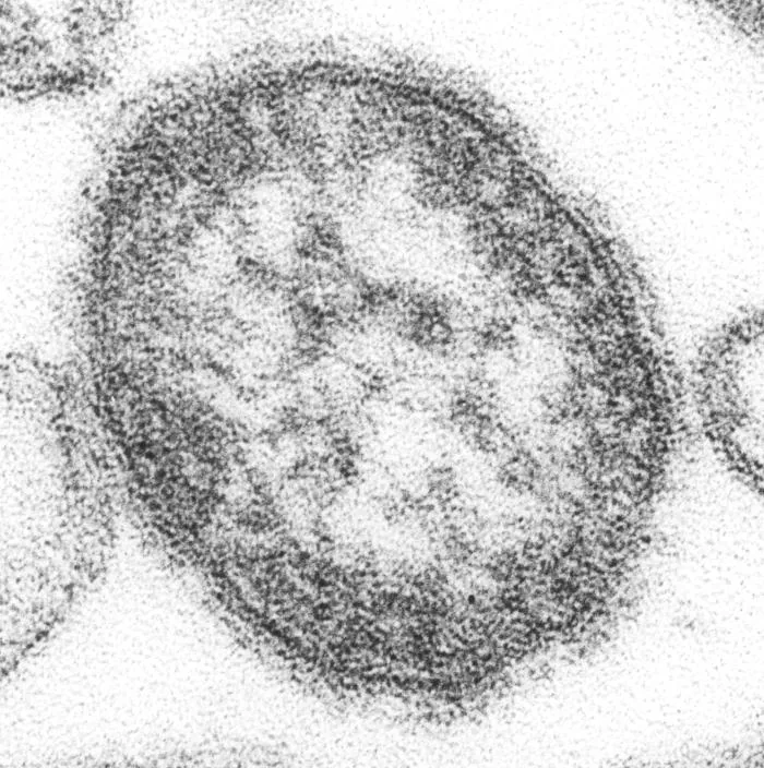 Particule du virus de la rougeole observée en microscopie électronique à transmission.